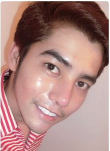 เสริมจมูกหลังหล่อ