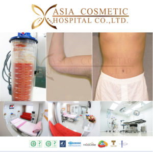 ดูดไขมันที่ไหนดี