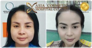 ตัดกราม