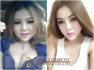 ตัดกราม