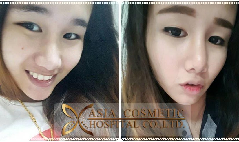 ทำดั้งสวย