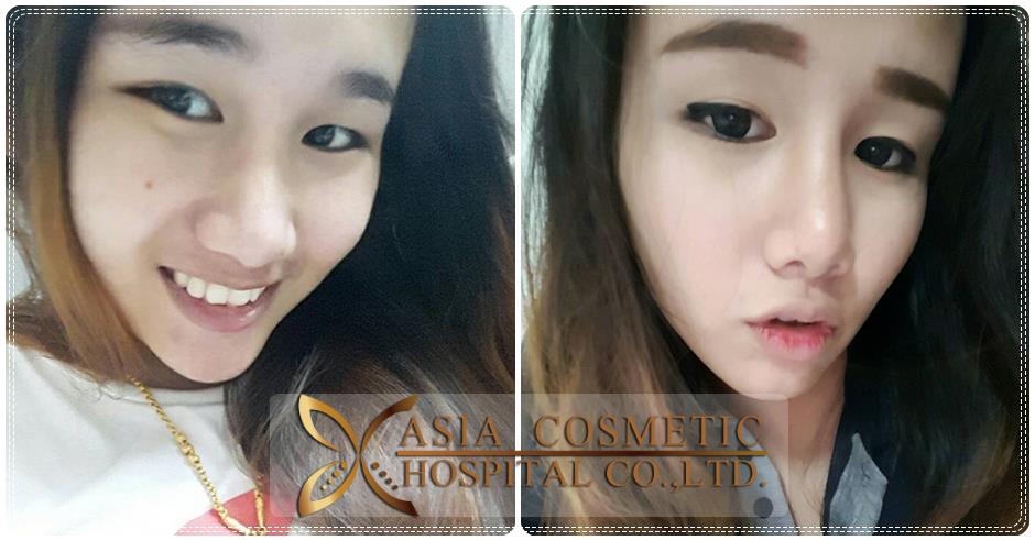 ทำดั้งสวย