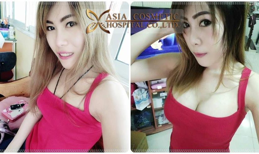 เสริมอก