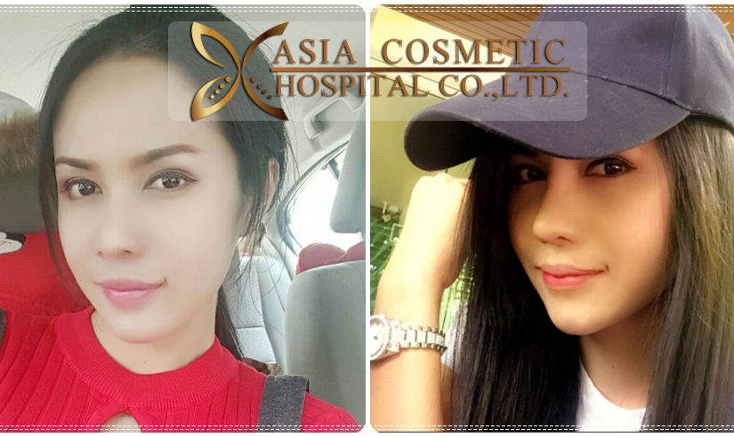 แต่งปลายจมูก