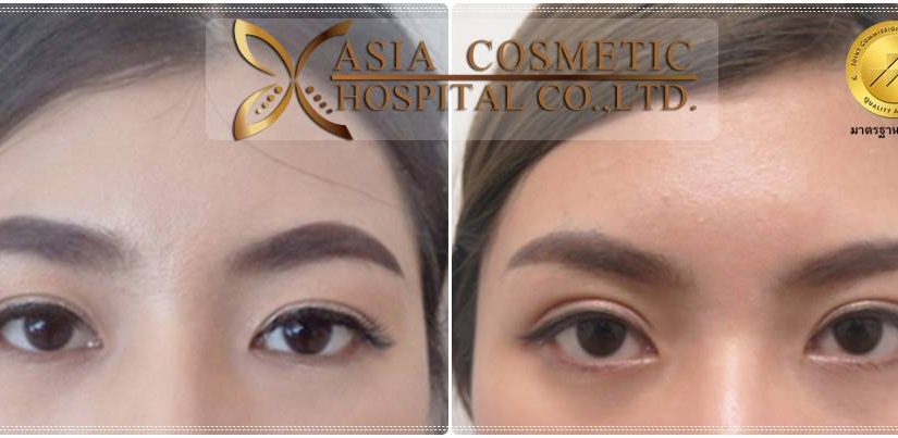 ตา2ชั้นสวยๆ