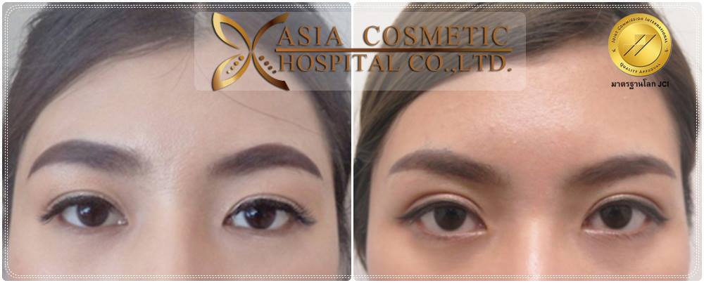 ตา2ชั้นสวยๆ