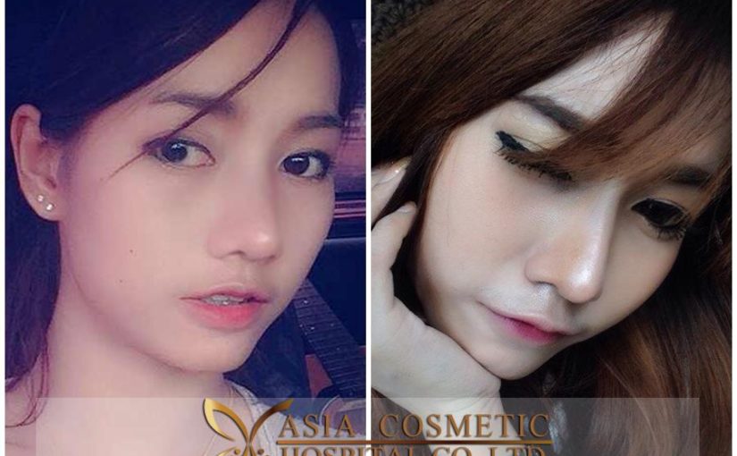 รีวิวทำดั้ง