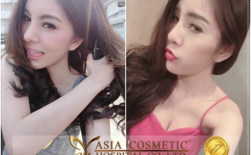 รีวิวการแก้จมูก