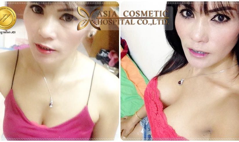 ทำนมที่ไหนดี