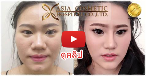 ตัดกราม-ลดโหนกแก้ม