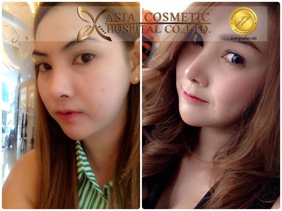 แก้จมูกที่ไหนดีคะ