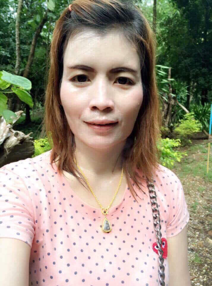 ลดโหนกแก้ม