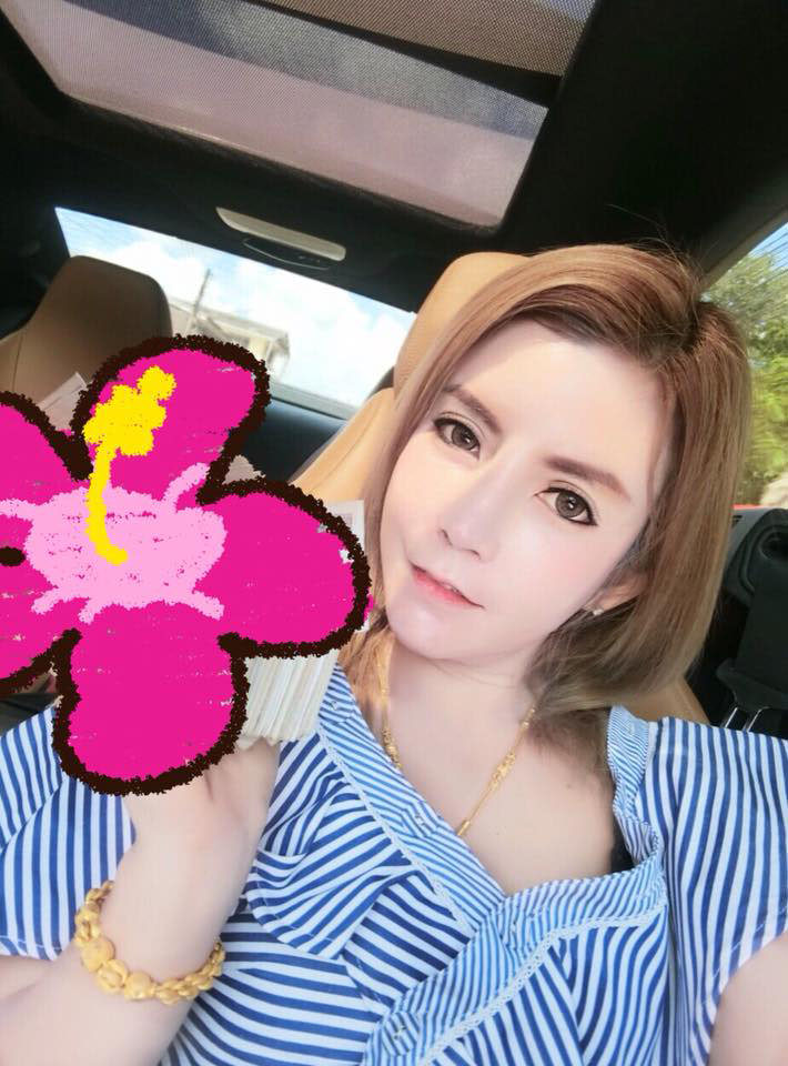 ศัลยกรรมลดโหนกแก้ม