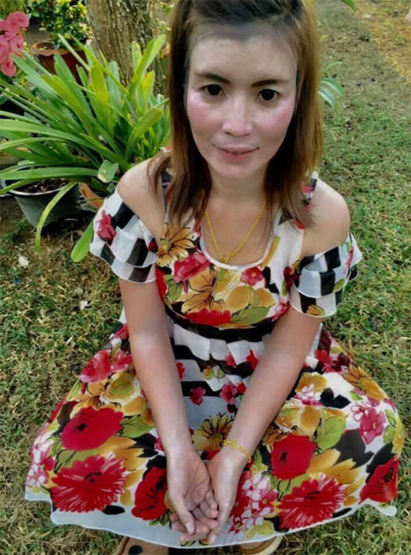 รูปก่อนทำศัลยกรรม