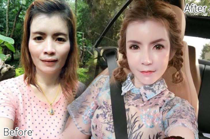 ศัลยกรรมพลิกชีวิต