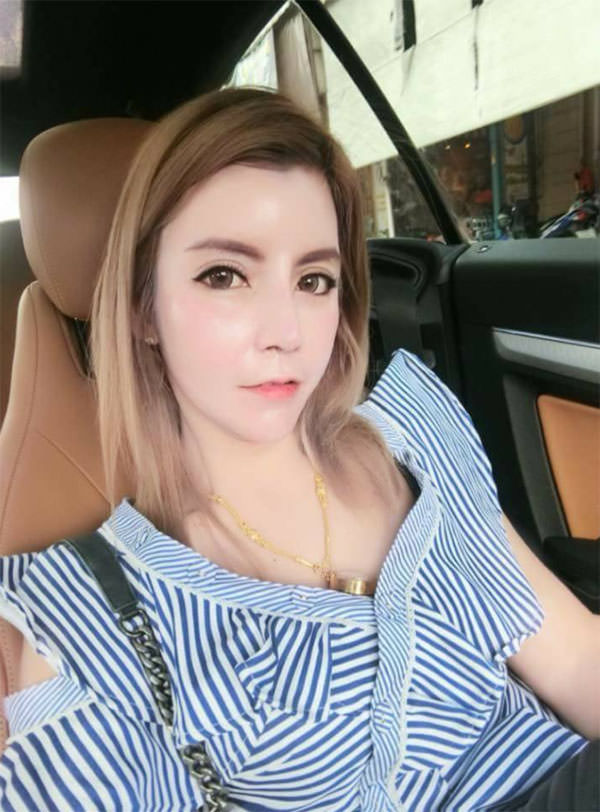 ศัลยกรรมหน้าเด็ก