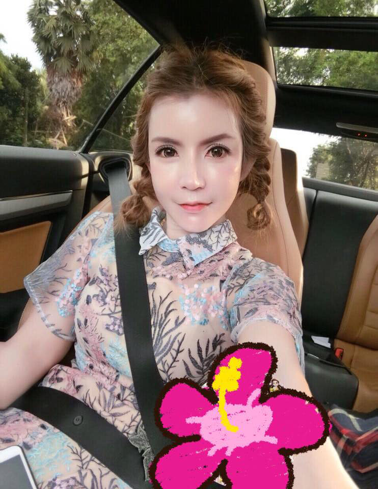 ผ่าตัดลดโหนกแก้ม