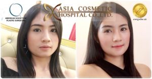 ตัดกราม