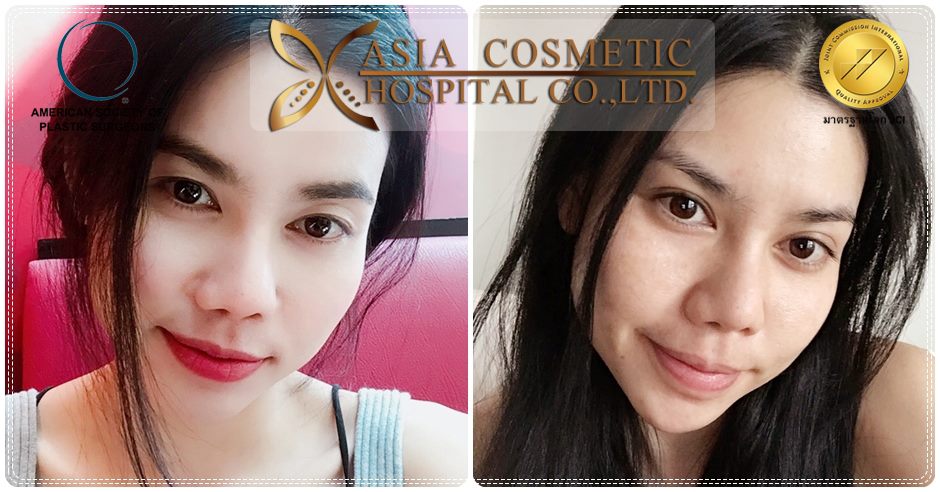 ทำตาสองชั้น