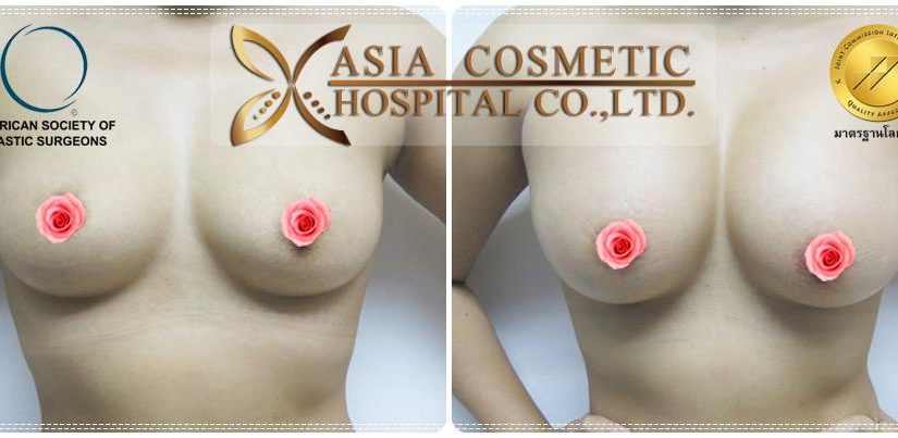 เสริมนม