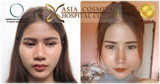 ปรับรูปหน้า