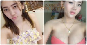 รีวิวเสริมนม 2019