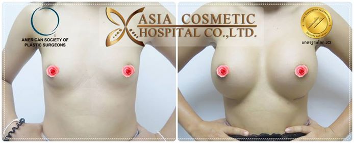 ทำอกอึ๋ม