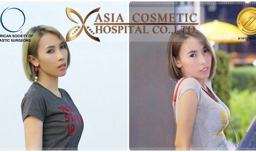 เสริมนม หมอทนงศักดิ์