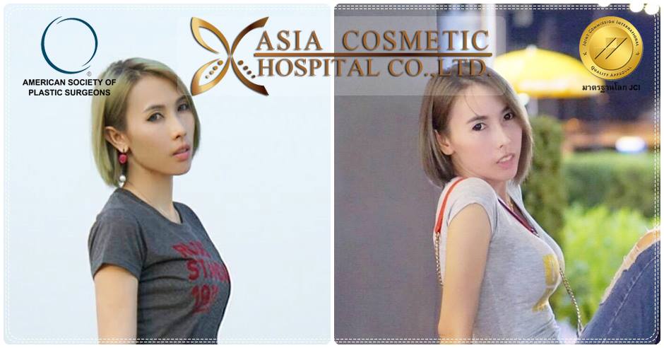 เสริมนม หมอทนงศักดิ์