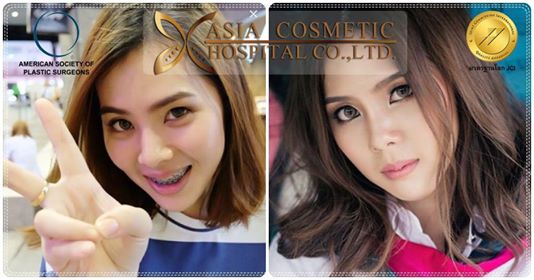 แก้จมูก หมอทนงศักดิ์