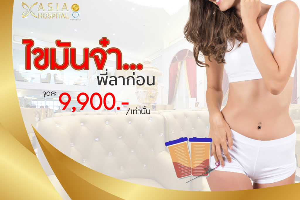 ดูดไขมัน